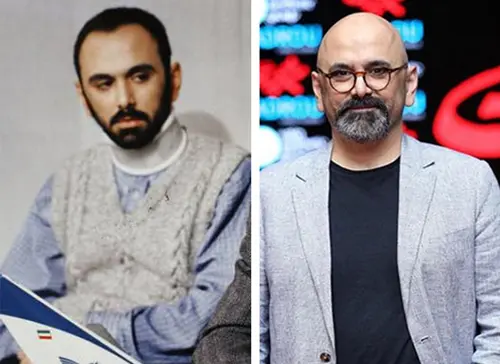بازیگران کچل ایرانی