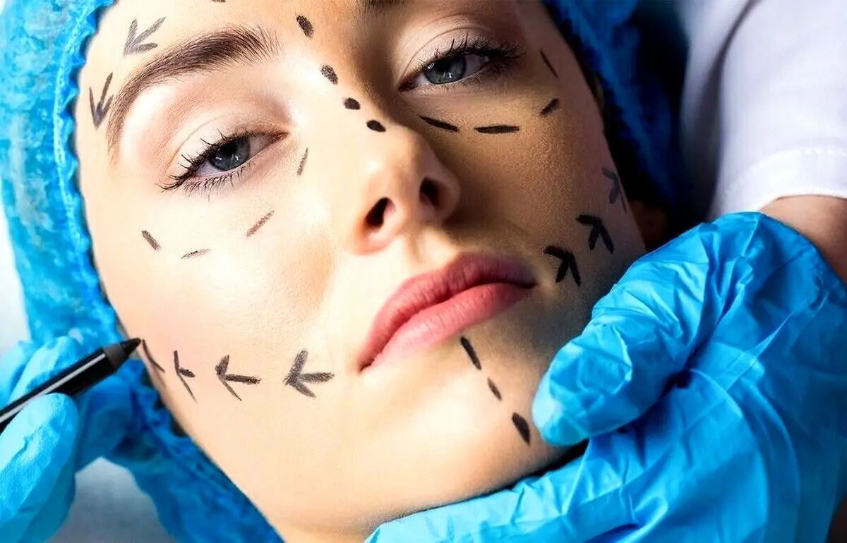 عجیب ترین عمل های زیبایی ایران