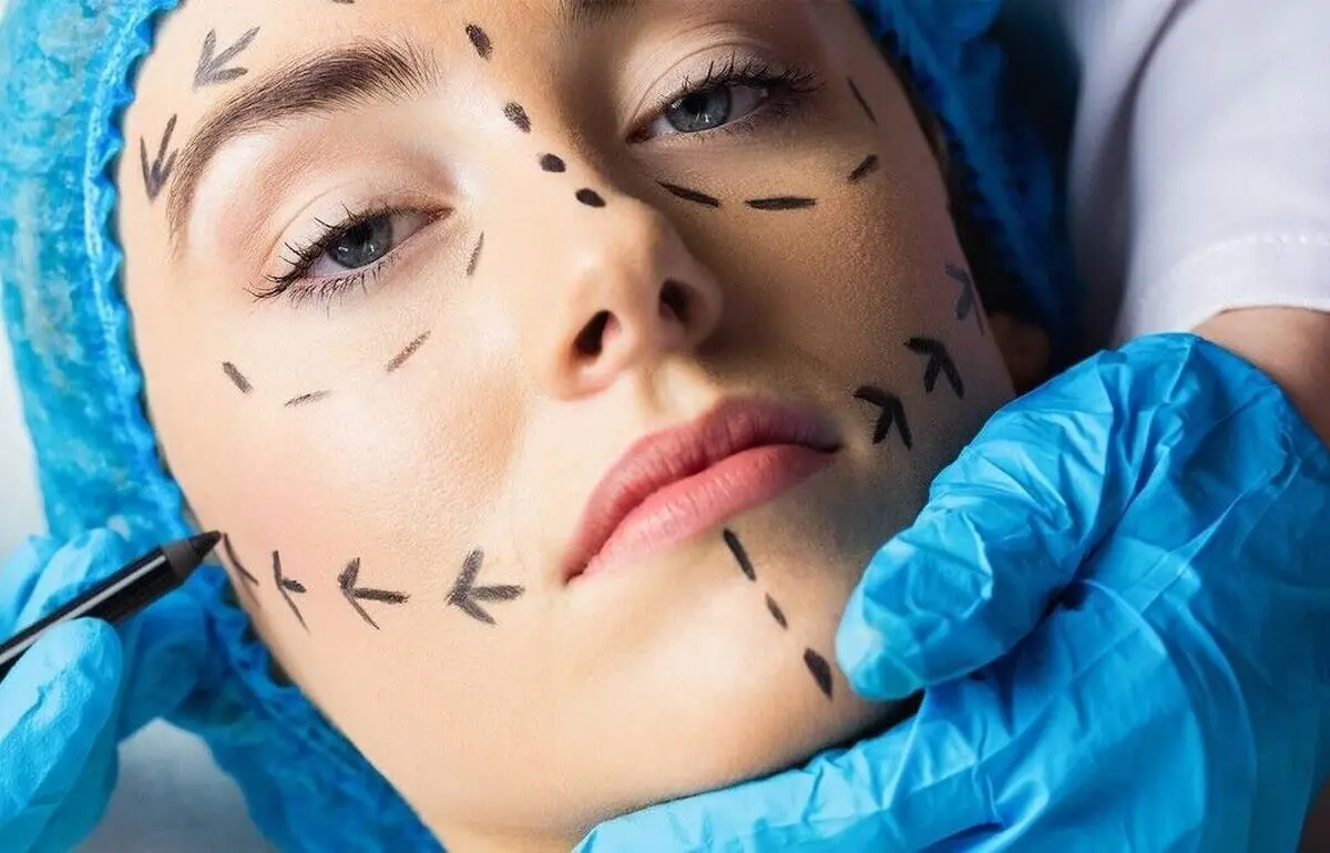 عجیب ترین عمل های زیبایی ایران