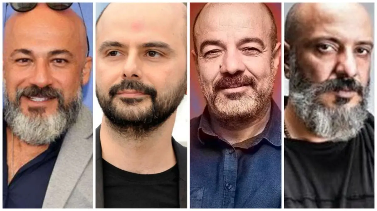 بازیگران کچل ایرانی