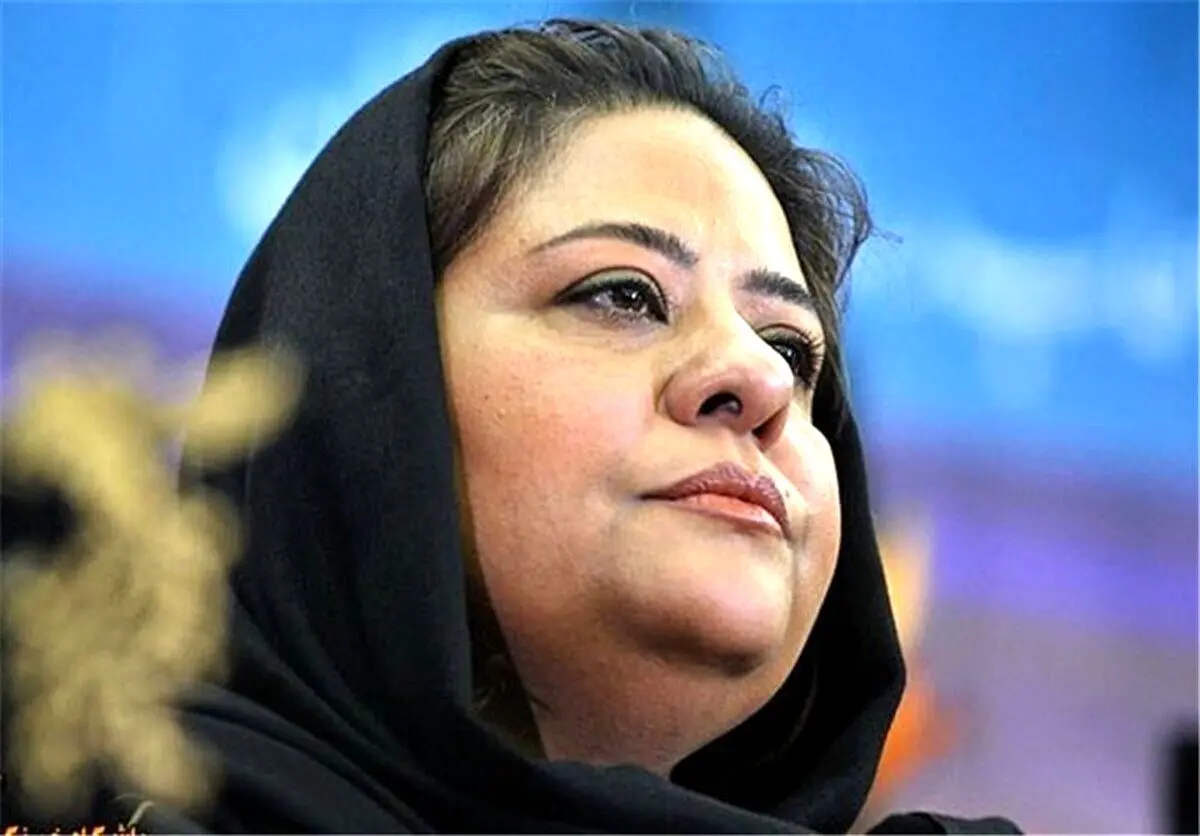 تغییر چهره باور نکردنی رابعه اسکویی بعد از عمل زیبایی + عکس