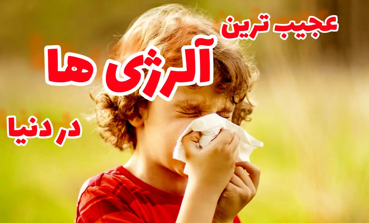 عجیب ترین آلرژی ها