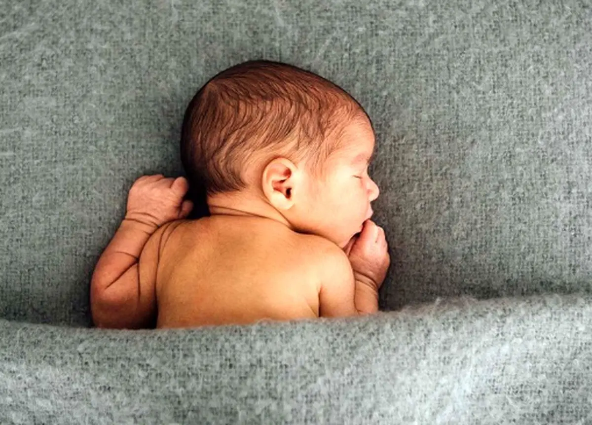 به دنیا آمدن نوزادی با دم ۱۲ سانتی متری + تصویر